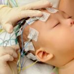 Почему прививка бцж гноится у новорожденного