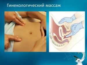 Гинекологический массаж при планировании беременности
