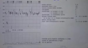 Что обозначают ритмичные движения плода на 9 месяце