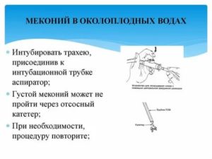 Что такое выход мекония в амниотическую жидкость