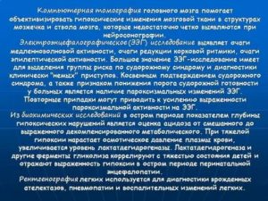 Что такое гипоксические изменения головного мозга у новорожденного