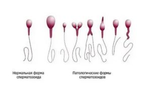 Как улучшить качество спермограммы для зачатия народными средствами