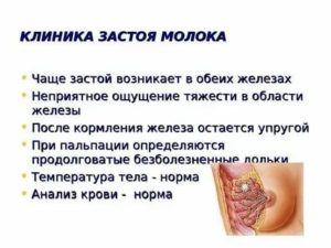 Что делать при застое грудного молока в домашних условиях отзывы