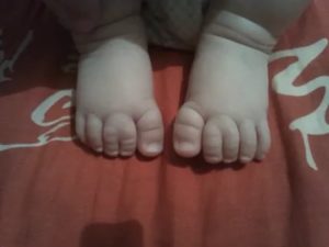 Почему у новорожденных сросшиеся пальчики на ногах
