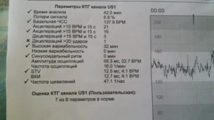 Как подготовиться к ктг плода утром