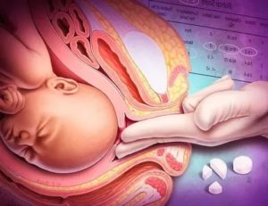 Зачем стимулируют роды на 38 неделе беременности