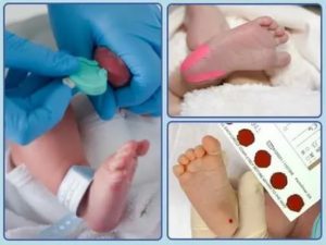Почему у новорожденных берут кровь именно из пятки