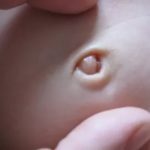 Почему после родов видно уретру