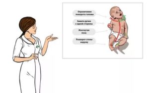 Почему грудной ребенок вертит головой в разные стороны