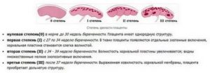 Как остановить раннее старение плаценты