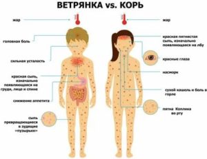 Может ли ветрянка повлиять на бесплодие у мужчин