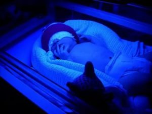 Сколько времени проводится фототерапия новорожденному