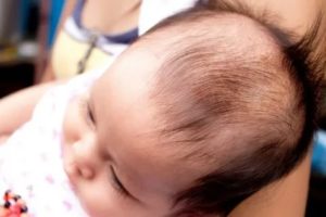 Как избавиться от перхоти на голове у новорожденного
