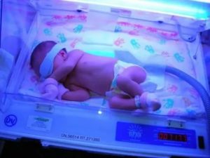 Как билирубин выводится с калом у новорожденных