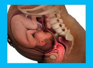Можно ли беременеть при параовариальной кисте