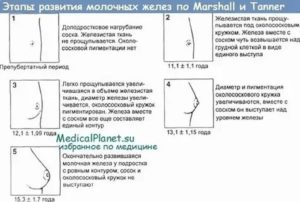 Почему не растет грудные железы в 14 лет месячные есть