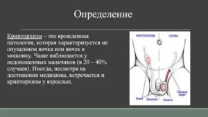 Когда у новорожденных опускаются яички комаровский