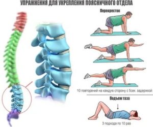 Можно ли беременеть при межпозвоночной грыже поясничного отдела