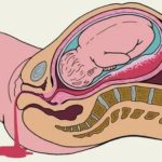 Почему сухо в интимной зоне при возбуждении после родов