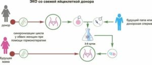 Как правильно выбрать донора спермы для эко