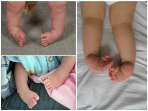 Что значит если у новорожденного ножки дрожат при вытягивании