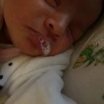 Частый герпес на губах влияние на зачатие ребенка