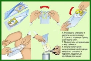 Как поймать мочу у новорожденного мальчика