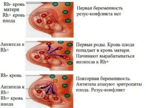 Келл в крови и зачатие