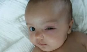 Почему у новорожденного дергаются глазки