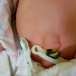 Почему чешется живот после родов