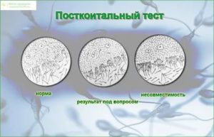 Кто делал тест на совместимость при бесплодии